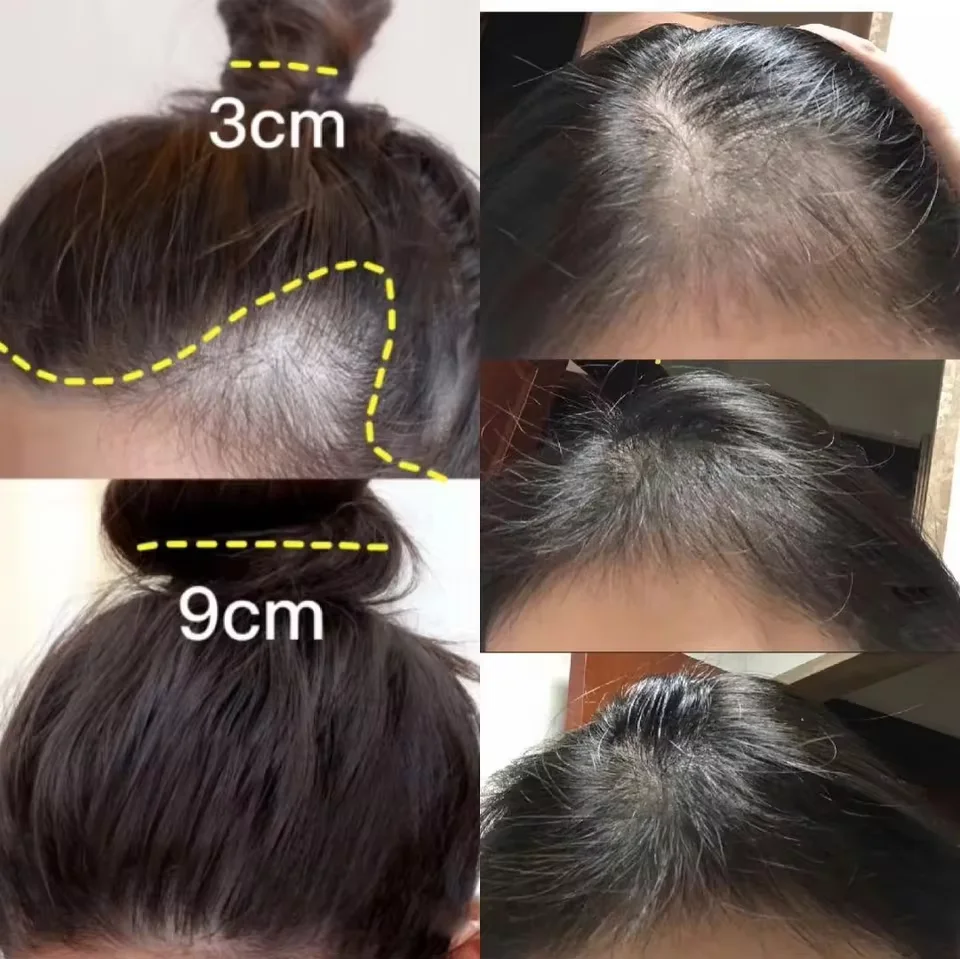 Schnelle Ingwer Haar Wachstum  – Hair Care Elseve Bewertung und Preis