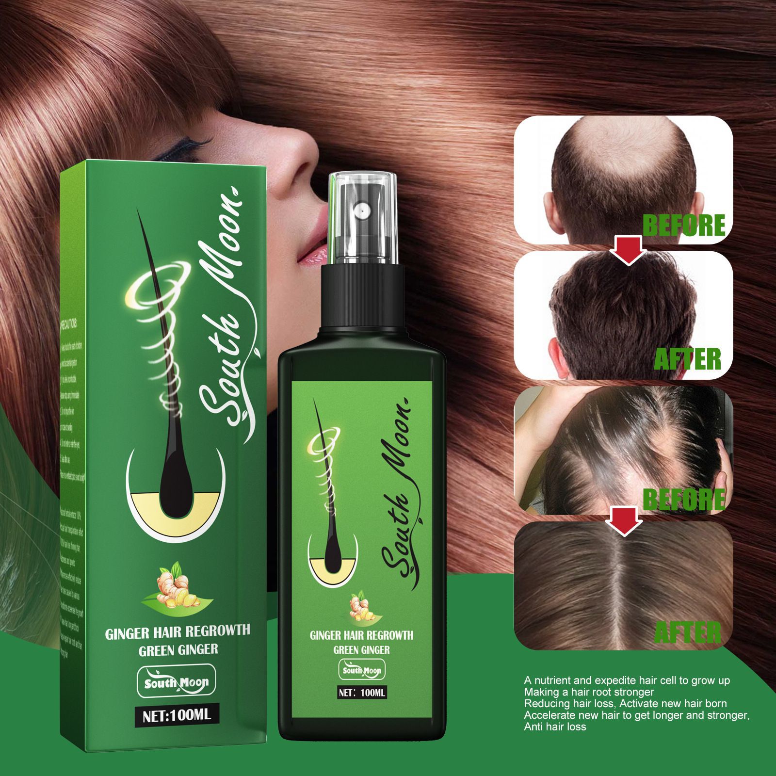 South Moon Ingwer Haarwuchsspr – Hair Care Elseve Bewertung und Preis