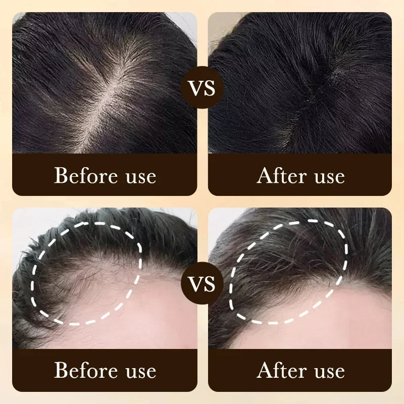Biotin Schnelles Haarwuchsöl P – Hair Care Elseve Bewertung und Preis
