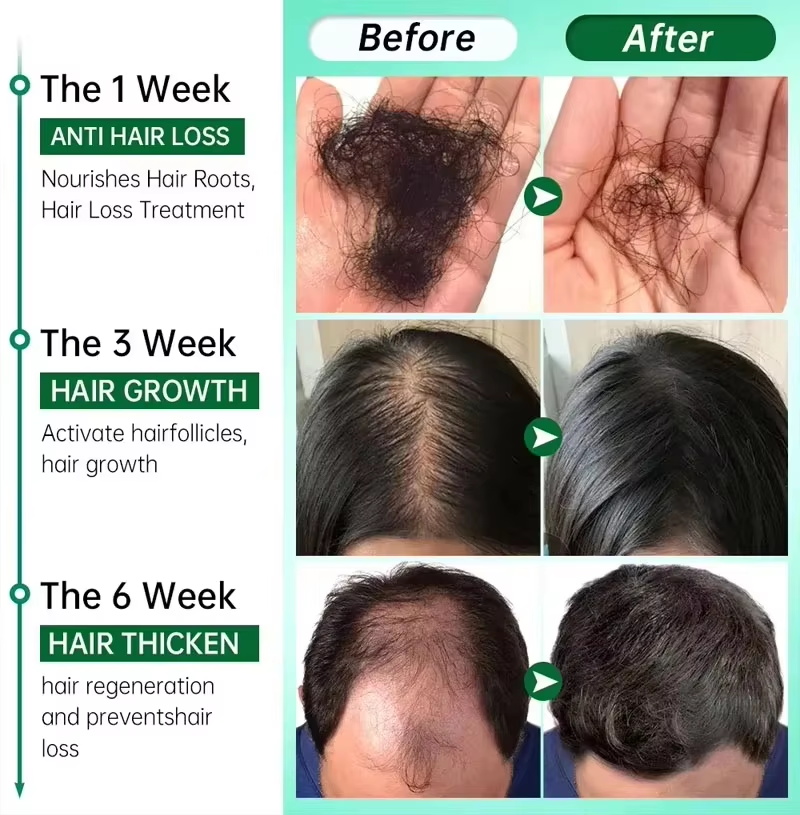 Haarwuchsserum, 7 Tage schnell – Hair Care Elseve Bewertung und Preis