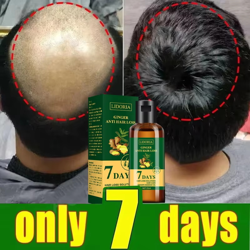 Haarwuchsserum, 7 Tage schnell – Hair Care Elseve Bewertung und Preis
