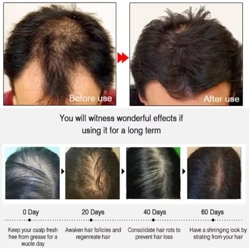 Haarwuchsserum, 7 Tage schnell – Hair Care Elseve Bewertung und Preis