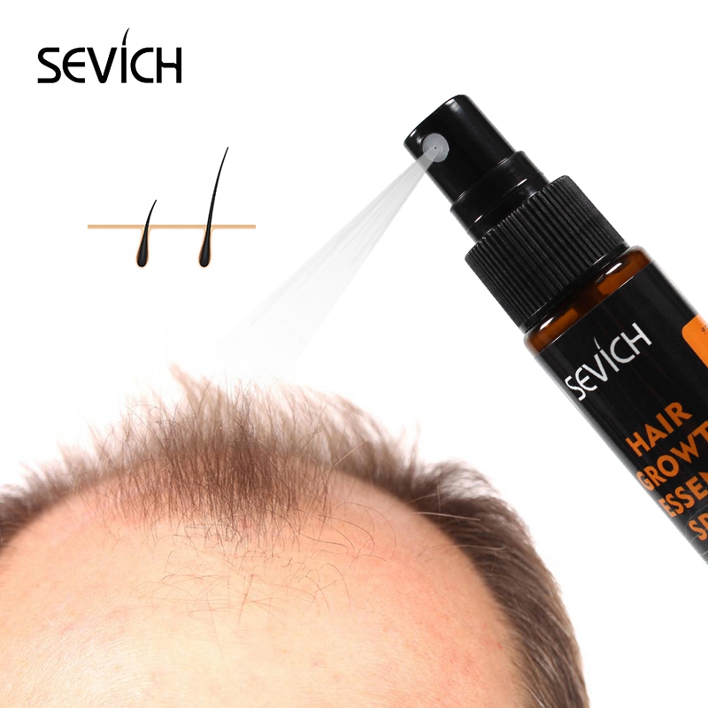 Sevich 30ml Hebal Öl Essenz Sc – Hair Care Elseve Bewertung und Preis