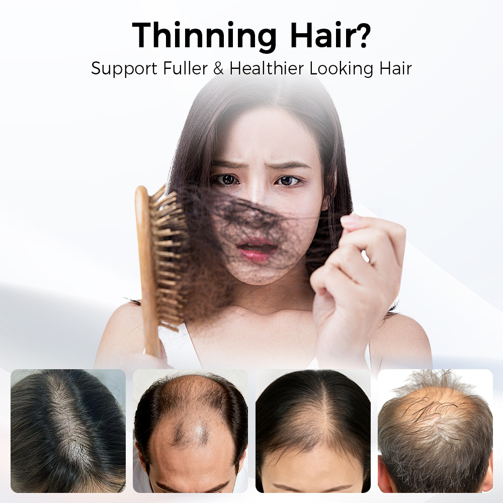 LED-Haarwuchskappe mit Rot-Bla – Hair Care Elseve Bewertung und Preis